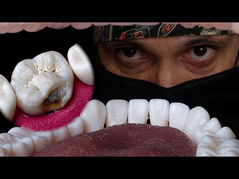 Incredible Work By Failure And Demotivated Dentist ! Artistic Tooth Restoration