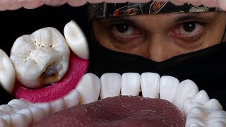Incredible Work By Failure And Demotivated Dentist ! Artistic Tooth Restoration