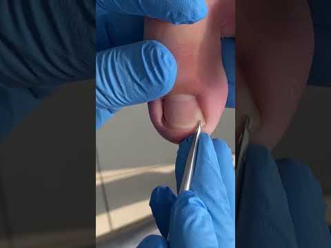Satisfying pedicure video!  #shorts #manicuresvideos #pedicure #ASMR