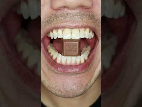 Gracias 🌸| Ritter SPORT Cubes Thank You Chocolate 🍫 #DoctorTristanPeh #ASMR #shorts