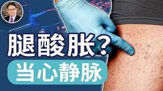 遠離血栓和腿部衰老，這4招每天堅持！靜脈曲張是身體在求救！ ｜四維健康