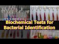Microbiology Enzyme and Test Concepts