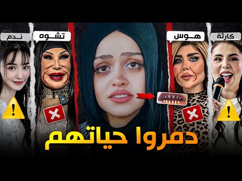 أفشل عمليات تجميل دمرت المشاهير #5