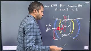 क्या फ़िस्टूला बिना ऑपरेशन के ठीक हो सकता है? 