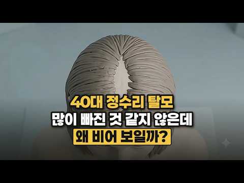 40대 정수리 탈모 원인, 많이 빠진 것 같지 않은데 비어 보이는 이유와 확인하는 법