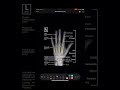 Lateral Hand X-Ray Techniques