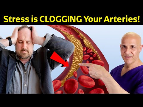 Stress: The Silent Artery Clogger Despite Healthy Eating!  Dr. Mandell