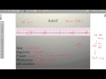 Junctional Rhythm Characteristics and Differences