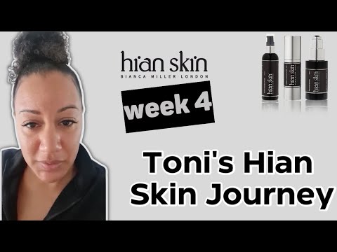 Toni's Hian Skin Journey Week Four: Very Soft Skin - Hian Skin - Bianca Miller London