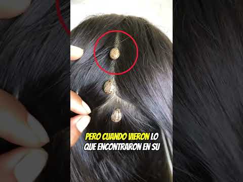 Algo salió de mi cabello 😨⚠️
