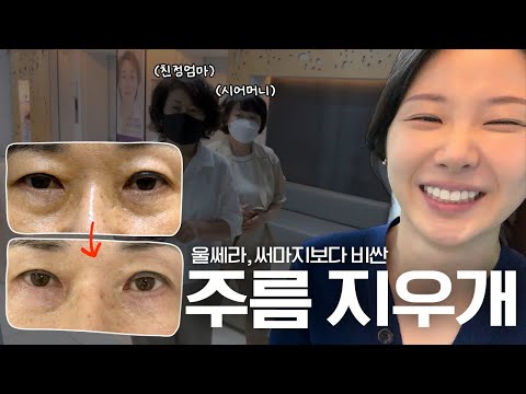 진짜로 주름이 지워지는 시술 내돈내산 리얼후기 (대받녀 중 역대급 효과..)