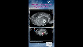 How would you interpret the B-mode and color Doppler image?