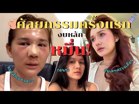 ศัลยกรรมครั้งแรกในชีวิต!!โดนหมอสั่งถอด ร้องไห้7วัน7คืน!!!