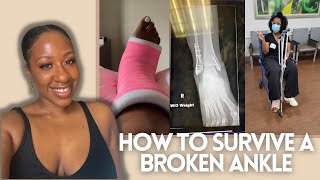 I BROKE MY ANKLE | HOW TO SURVIVE A BROKEN ANKLE