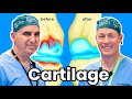 Cartilage Regeneration and Treatment Methods