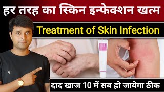 दाद खाज खुजली हर तरह के skin infection की बेस्ट क्रीम | Best cream.for Skin Infection