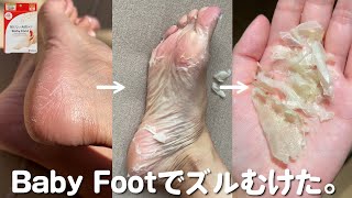 かかと脱皮したんだが・・・