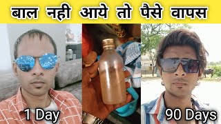 Best hair oil for hair growth | बाल नहीं आए तो पैसे वापस? 110% गारेंटी | hair growth oil