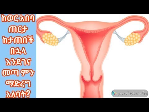 ከወር አበባ ሄይድ ጠርታ ከታጠበች በኋላ እንደገና ተመልሶ መጣ ምን ማድረግ አለባት? ሰላትና ጾሟስ ? ተመልከቱ  II ዲንህን እወቅ Dawaa & Peace II