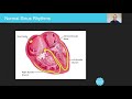 Understanding Sinus Rhythm and ECG