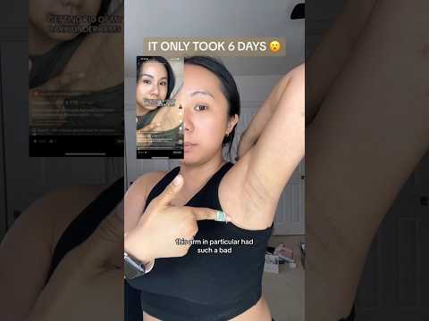 6 day underarm before & after // 5-in-1 product!