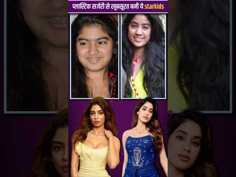 Plastic surgery Karake khoobshurat bane 😱by reviewdekho