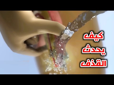 شاهد كيف يحدث القذف عند الرجل وكيف تصنع الحيوانات المنوية داخل جسمة (Male ejaculation)