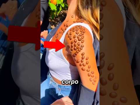 Se Isso Aparecer No Seu Corpo, Corra e Peça Ajuda! #shorts #cafe #dog #amor