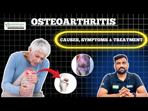 घुटनों के अर्थराइटिस : कारण , लक्षण और उपाय  | KNEE ARTHRITIS KYA HAI | Dr. Arvind Jaga