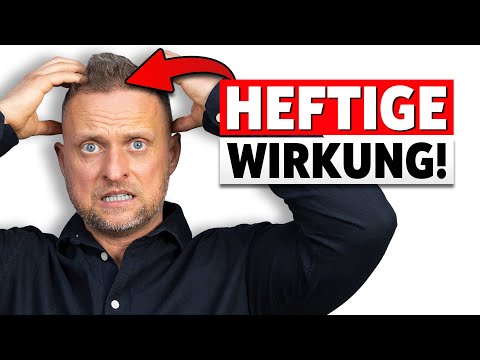 Keiner ahnte, wie heftig die Wirkung von Zwiebelsaft auf der Kopfhaut ist!