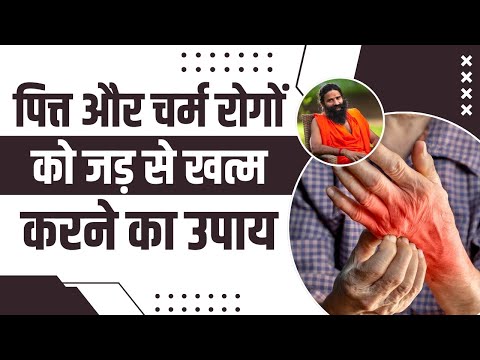 पित्त (Pitta) और चर्म रोगों (Skin Disease) को जड़ से खत्म करने का उपाय || Swami Ramdev