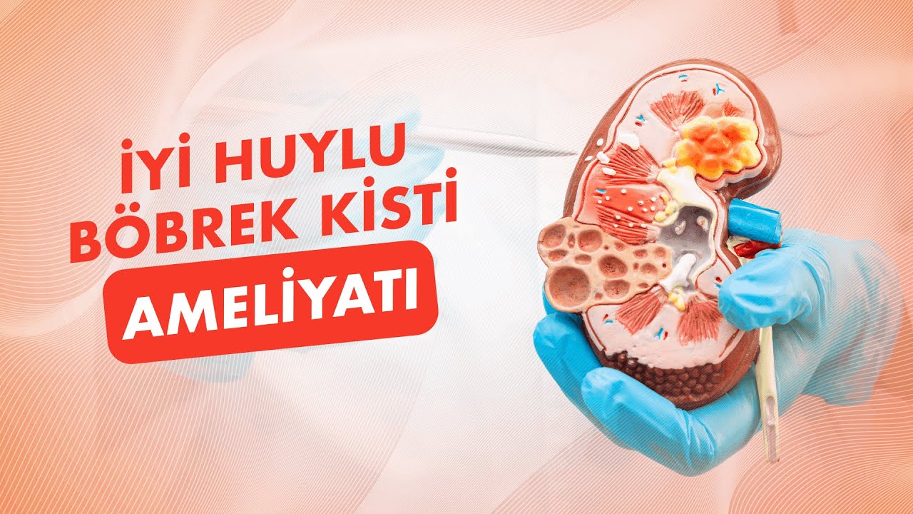 İyi Huylu Böbrek Kisti Ameliyatı