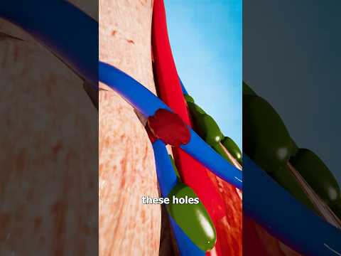 Blown Veins 😟 Doctor Explains