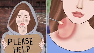 ASMR Remove Huge Neck Pus Cyst from Homeless girl | Severely injured animation