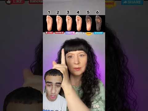 رجلك انهي فيهم 😱😱😳🤔