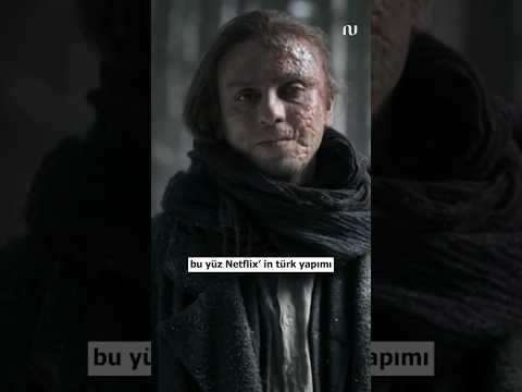 Bütün Set Onu Bekledi
