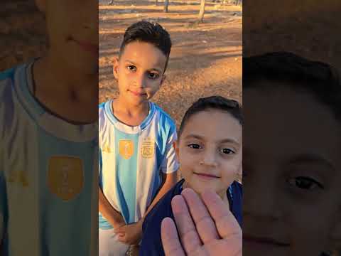 مسكين عبودي صاير اصلع لازم نساعده
