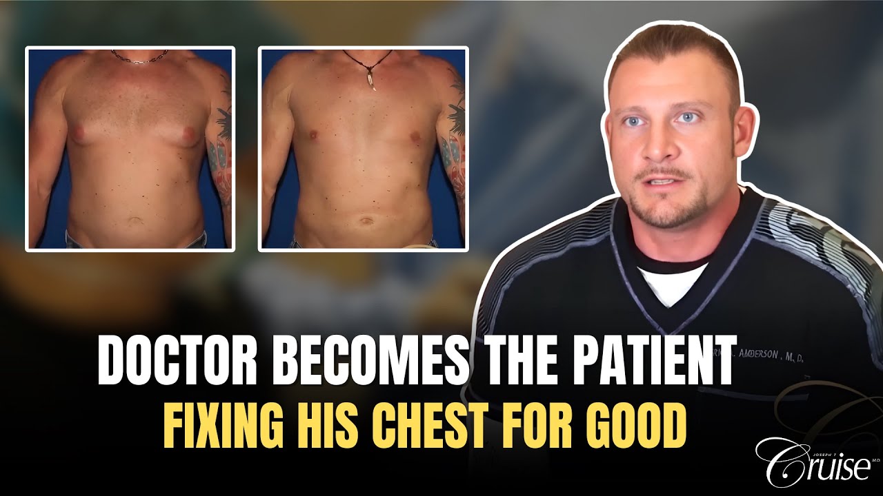 Before and after chest surgery transformation.