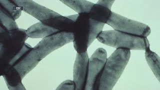 Deadly disease spreading in New York City, officials report