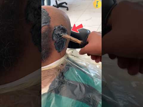 😱 Deep Ear Wax Cleaning! (@jocker.nagy)