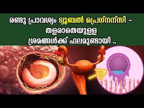 2 പ്രാവശ്യം ട്യൂബല്‍ പ്രെഗ്നന്സി - തളരാതെയുള്ള ശ്രമങ്ങള്‍ക്ക് ഫലമുണ്ടായി  |  muharram challenge 2025