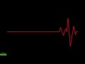 Understanding the Transcript