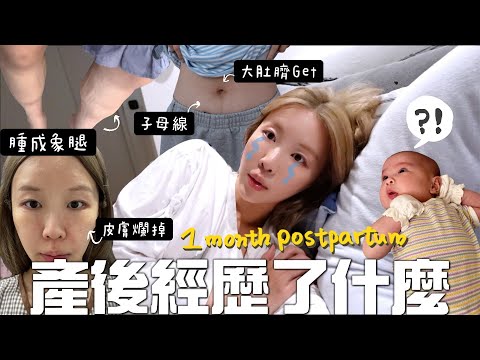 [VLOG] 2胎產後一個月結算!! 醫生偷偷動了手腳？2次開肚的疤痕? 肚臍變超大? 產後浮腫不是開玩笑⋯情緒低落？ [合作]｜Lizzy Daily