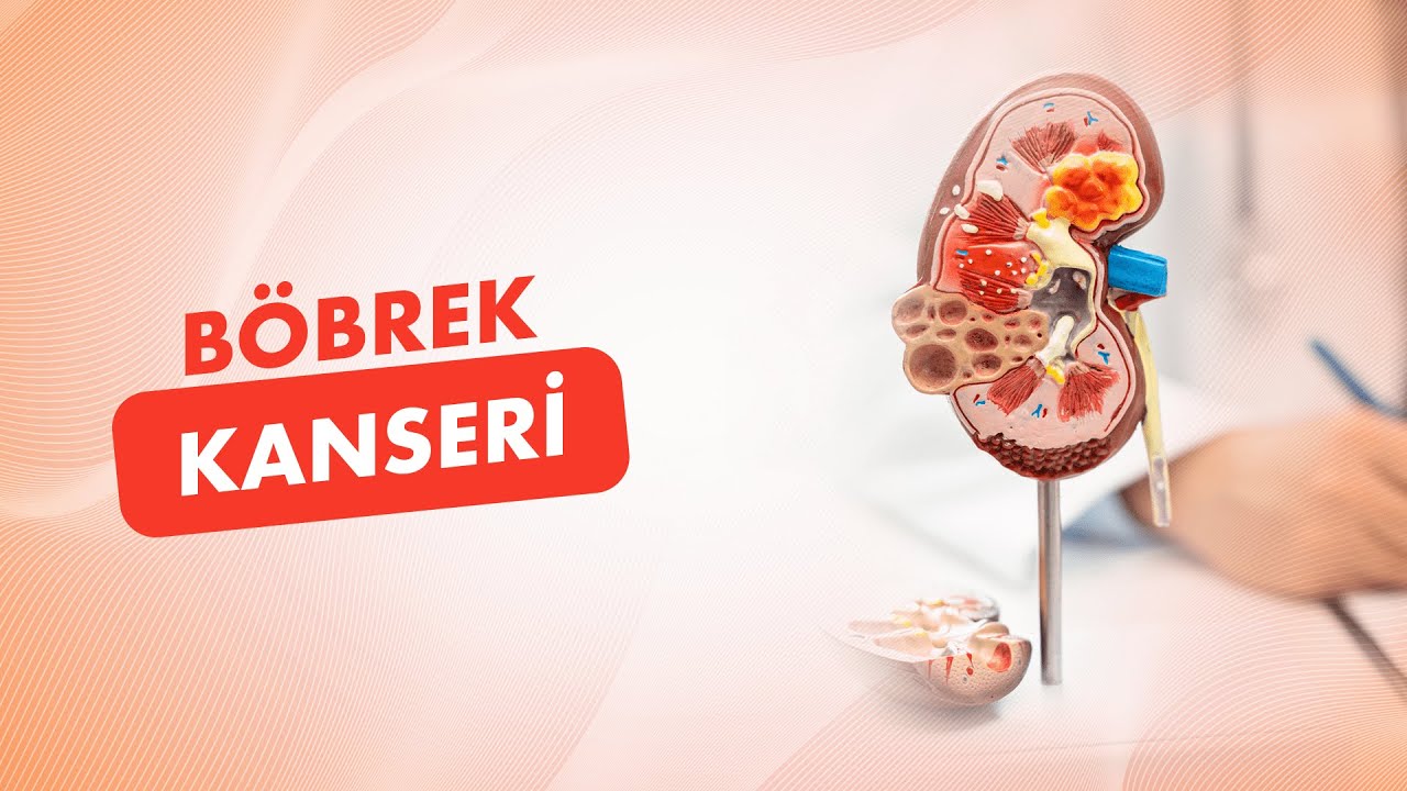 Böbrek Kanseri Nedir? Tanı ve Tedavi Yöntemleri Nelerdir?