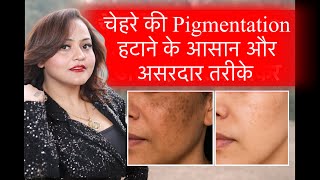 चेहरे की Pigmentation हटाने के आसान और असरदार तरीके ||  nisha Lambha