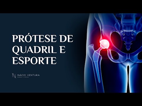 Prótese de quadril e esporte | Dr. Inácio Ventura