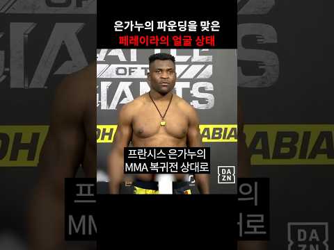 은가누의 파운딩에 맞은 페레이라의 얼굴 상태...