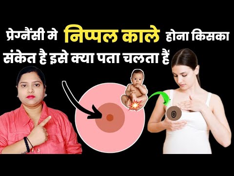 प्रेग्नैंसी मे निप्पल काले होना किसका संकेत है इसे क्या पता चलता हैं|babyboy prediction in pregnancy