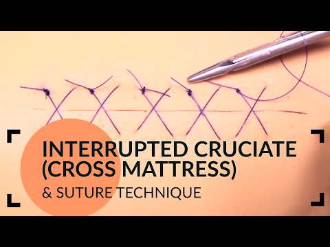 Interrupted Cruciate (Cross Mattress) Suture Technique