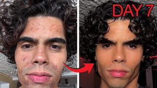 How I Looksmaxxed in 7 Days